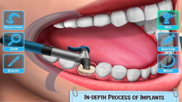 医生修个牙中文版