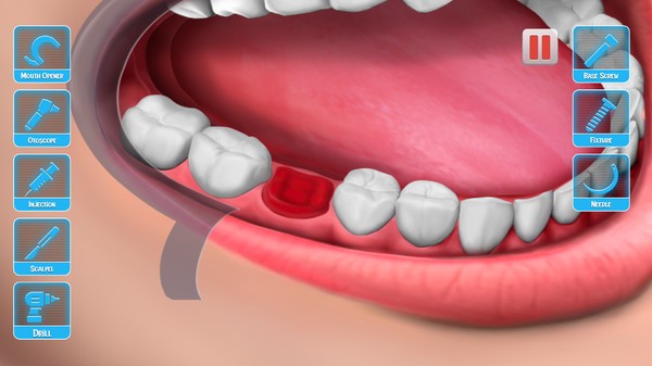 医生修个牙中文版