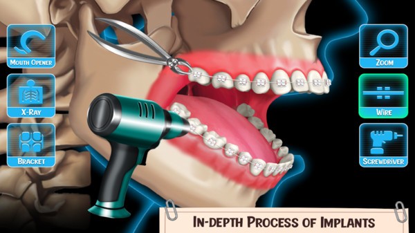 医生修个牙中文版
