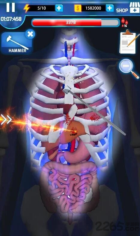 手术大师安卓中文版