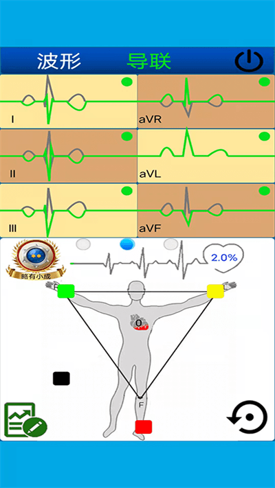 心电图计算器官方版 心电图计算器app下载