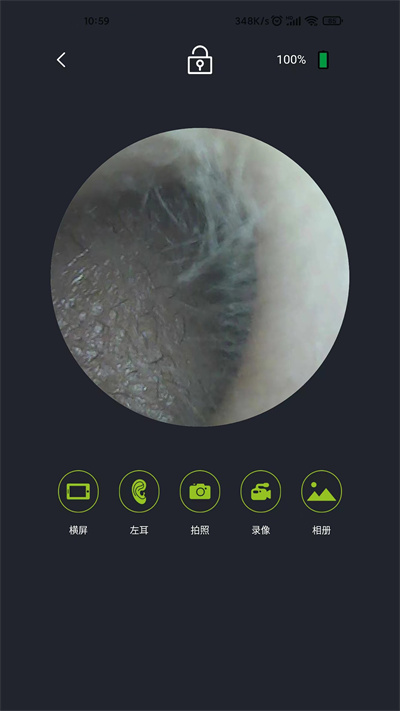 米螺采耳官方版