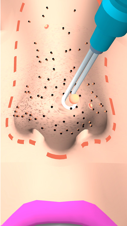 干净的鼻子手机版