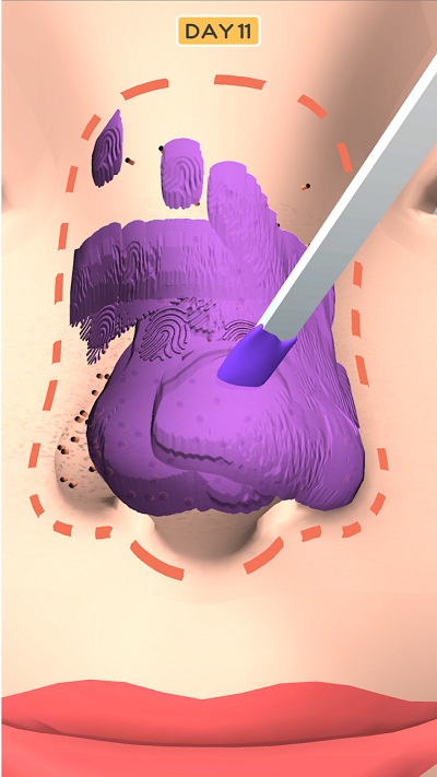 鼻子美容师游戏