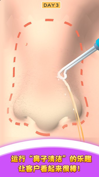 我爱挤黑头手机版