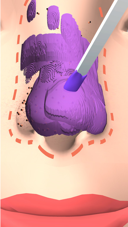 干净的鼻子手机版