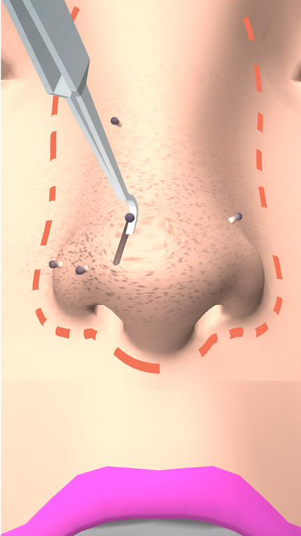 干净的鼻子手机版